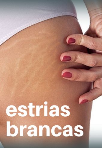 Guia de Formulações - Professor Mateus