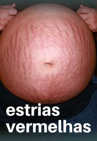 Guia de Formulações - Professor Mateus
